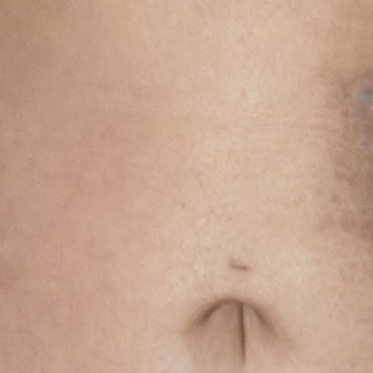 Başar Kaya Klinik Dövme Sildirme Şikayeti