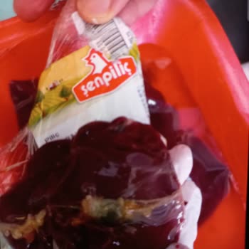 Şenpiliç Karaciğer Safra Kesesi Var