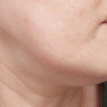 Dr. Arzu Kurtoğlu Doktor Deneyimim Ve Sonuçları