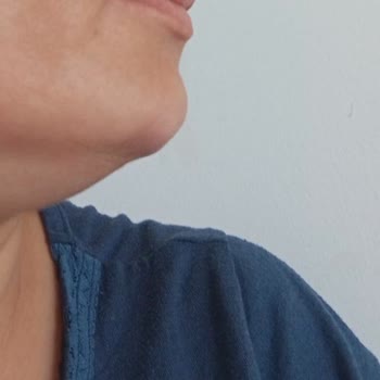 Dr. Arzu Kurtoğlu Doktor Deneyimim Ve Sonuçları