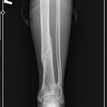 Metin Sabancı Baltalimanı Kemik Hastalıkları Eğitim ve Araştırma Hastanesi Kemik Hastalıkları Balta Limanı Hastanesi