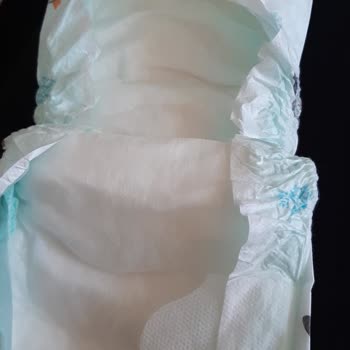 ebebek Bebek Bezinin Değişik Çıkması