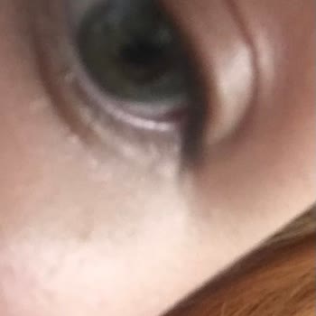 Luxe Optik Lens Yanlış Görsel Kullanımı