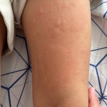 İstanbul Üniversitesi Tıp Fakültesi Çocuk Doktoru Tavrı Çok Duyarsızdı