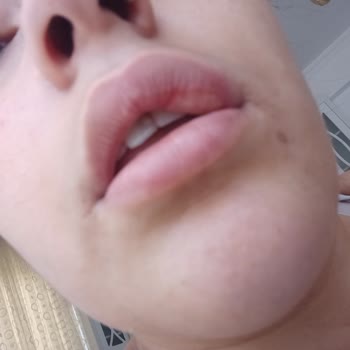 Estetica Bilgisiz Ve Tecrübesiz Hekimler Çalıştırıyor