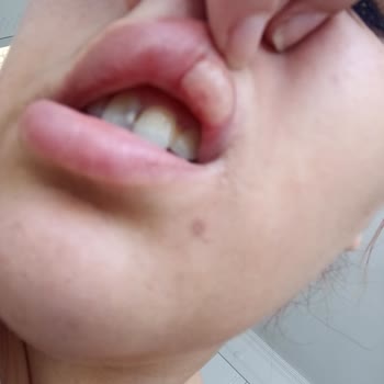 Estetica Bilgisiz Ve Tecrübesiz Hekimler Çalıştırıyor