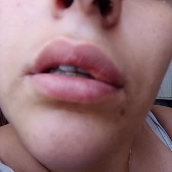 Estetica Bilgisiz Ve Tecrübesiz Hekimler Çalıştırıyor