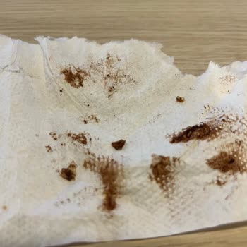 Eti Gıda Eti Karam Bize Plastik Mi Yediriyor