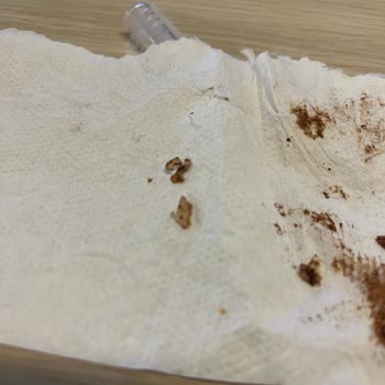 Eti Gıda Eti Karam Bize Plastik Mi Yediriyor