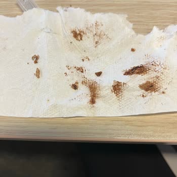 Eti Gıda Eti Karam Bize Plastik Mi Yediriyor