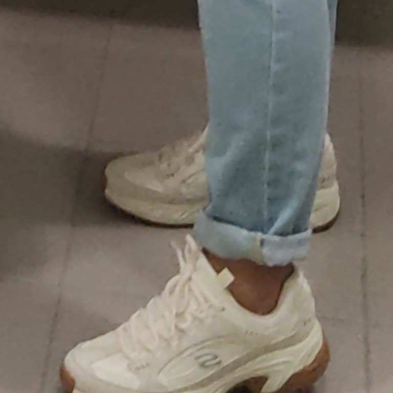 Skechers Ayakkabı Astar Yırtıldı, Dış Katmana Doğru Deformasyon Oluştu