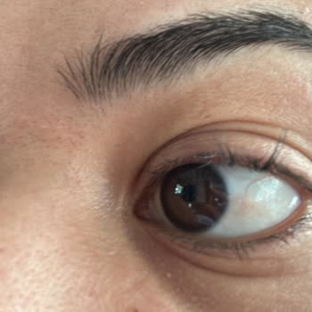 Neslim Güngen Güzellik Esenler Şubesinde İpek Kirpik Uygulaması Sorunu