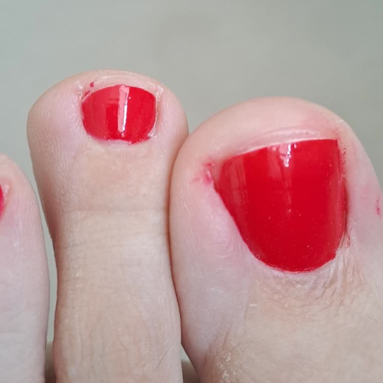 Gratis Beauty Hijyen Ve Hizmet Kalitesinde Büyük Hayal Kırıklığı