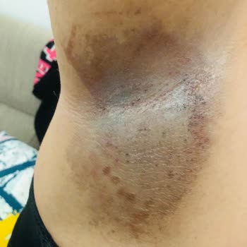 Agiss Ağda Bandı Şikayet