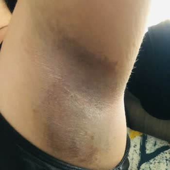 Agiss Ağda Bandı Şikayet