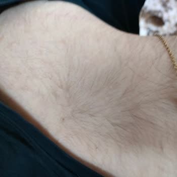 Aris Güzellik Merkezleri Aris Denizli Vp