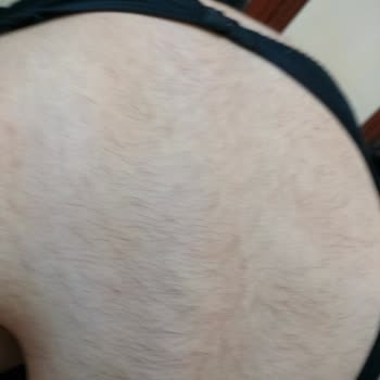 Aris Güzellik Merkezleri Aris Denizli Vp