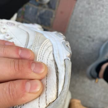 Skechers Tan Aldığım Ayakkabı Tabanından Kopma Yaptı.