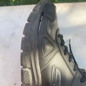 Skechers Ayakkabıda Açılma Sorunu