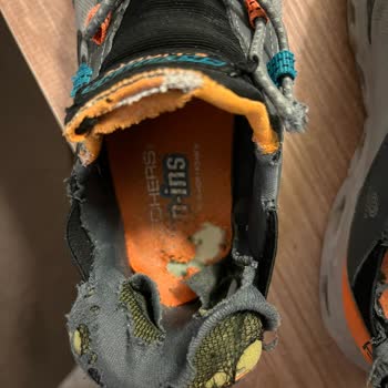 Skechers Ayakkabı 6 Ayda Parçalandı