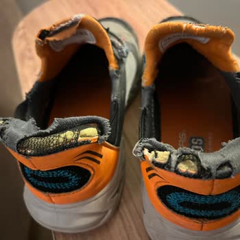Skechers Ayakkabı 6 Ayda Parçalandı