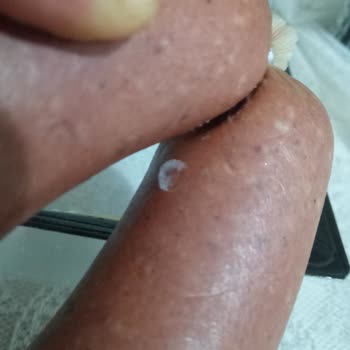 Ülker Marketten Alınan Sucukta Küf Sorunu