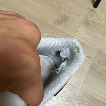 adidas 3 Aylık Ayakkabının Her Yerinde Sorun Çıktı.