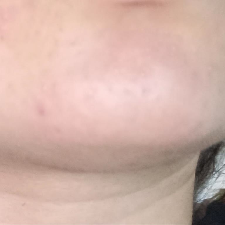 Loreal Paris Nem Terapisi Şikayetim