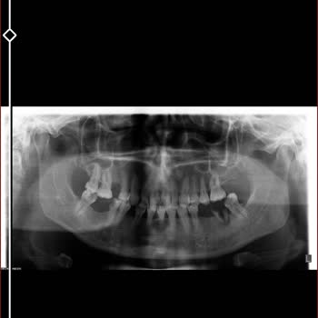 Kocaeli Üniversitesi Diş Hekimliği Fakültesi Endodontiye Randevu Alamıyorum Kayıt Açık Oldu Halde