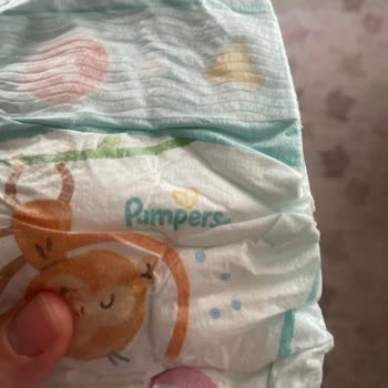 Prima Diapers Caused Skin Irritation