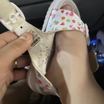 Vicco Kızımın Ayaklarını Yara Yaptı