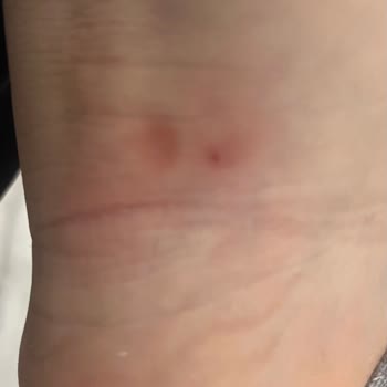 SuperStep Skechers Marka Ayakkabı Ayağımı Vuruyor