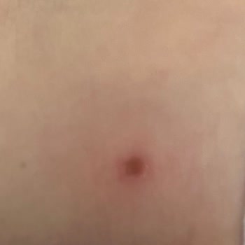 SuperStep Skechers Marka Ayakkabı Ayağımı Vuruyor