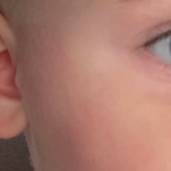 Mustela 50 SPF Güneş Kremi Kızarıklık