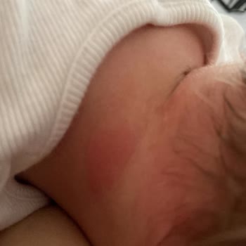 Mustela 50 SPF Güneş Kremi Kızarıklık