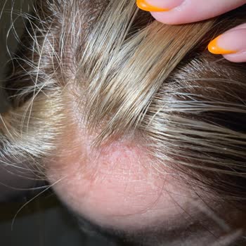 MD Saç Tasarım (İzmir) Md Saç Tasarım