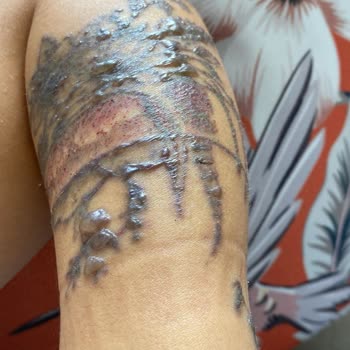 Leon Güzellik Merkezi (Sivas) Sivas Leon Dövme Silme