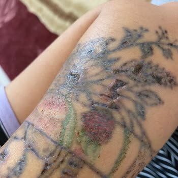 Leon Güzellik Merkezi (Sivas) Sivas Leon Dövme Silme