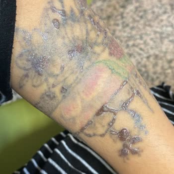 Leon Güzellik Merkezi (Sivas) Sivas Leon Dövme Silme