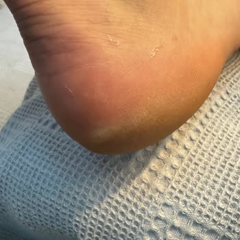 Lescon Satış Sonrası Hizmet Hk.