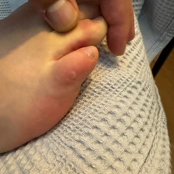 Lescon Satış Sonrası Hizmet Hk.