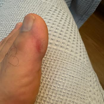 Lescon Satış Sonrası Hizmet Hk.