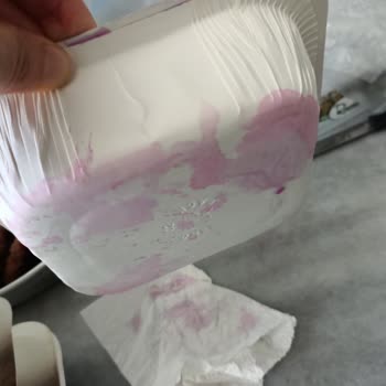 Dönerci Celal Usta Siparişim Çöp Gibiydi