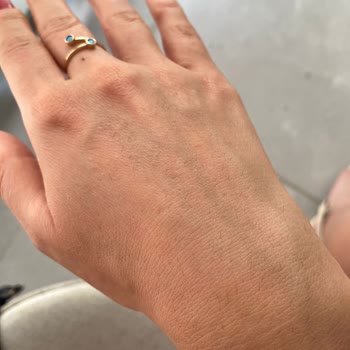 Antalya Lara Güzellik Merkezi Olmayan Tüylerimi Çıkarttı