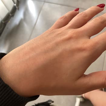 Antalya Lara Güzellik Merkezi Olmayan Tüylerimi Çıkarttı