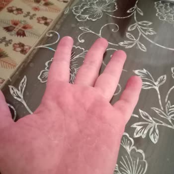 Tereson'dan Şikayetçiyim Bunu Kim Ürettiyse Derhal Kaldırılmalı.