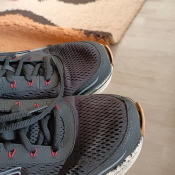Skechers Ayakkabı Şikayeti Hakkında