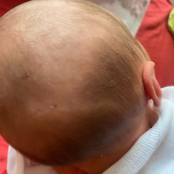 Bursa Şehir Hastanesi'nde Doğum Deneyimim Hijyen Ve Profesyonellik Eksikliği