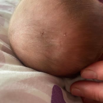 Bursa Şehir Hastanesi'nde Doğum Deneyimim Hijyen Ve Profesyonellik Eksikliği