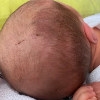 Bursa Şehir Hastanesi'nde Doğum Deneyimim Hijyen Ve Profesyonellik Eksikliği